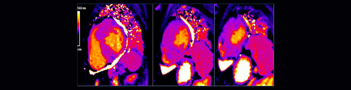 Cardiac-T1-mapping