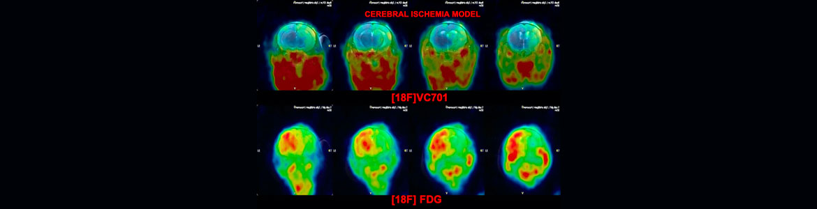 Cerebral-Iscemia-Model