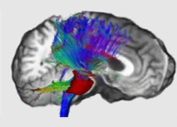 NEUROIMAGING