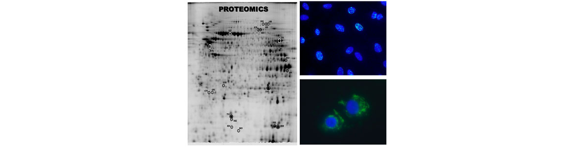 Proteomics